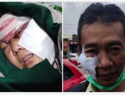 2 Orang Terluka, ODGJ Sekitar Jalan Imam Bonjol Lempari Orang-Orang dengan Batu