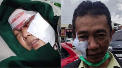 2 Orang Terluka, ODGJ Sekitar Jalan Imam Bonjol Lempari Orang-Orang dengan Batu