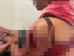 Sadis, Seorang Ibu Nyaris Tewas Ditangan Anak Kandungnya Sendiri