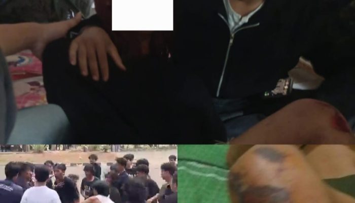 Keluar dari GSG, Mahasiswa FP Unila Diduga Dikeroyok: Korban Lapor Polisi